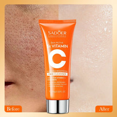 SADOER Skin Active 5x Vitamin C Whitening Brightening Face Cleanser - 100g Sadoer