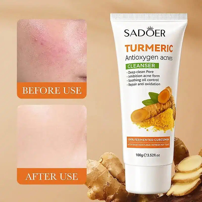 SADOER Turmeric AntiOxygen Acne Facial Cleanser - 100g Sadoer