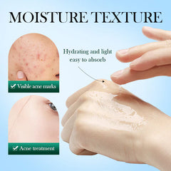 Sadoer Tea Tree Acnes Oil Control Face Toner - 120ml Sadoer