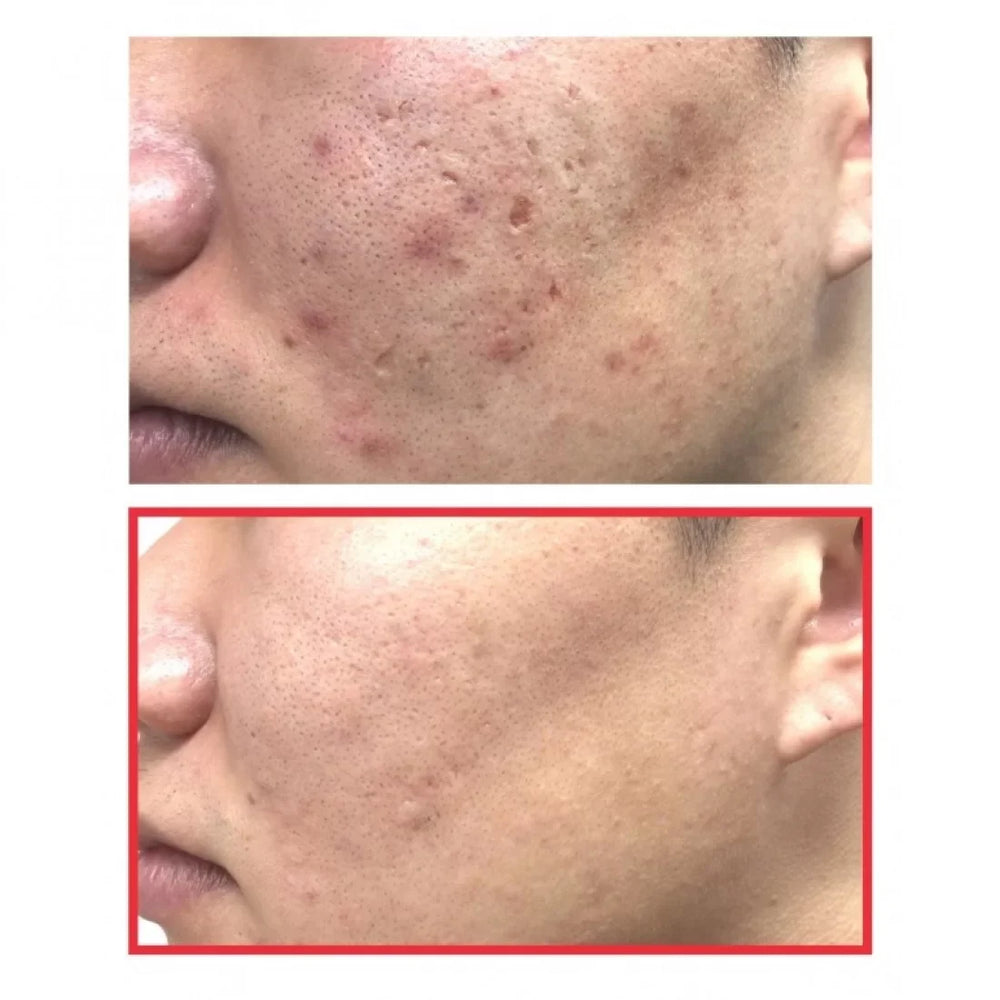 Some By Mi - Snail Truecica Miracle Repair Cream 60g Some By Mi