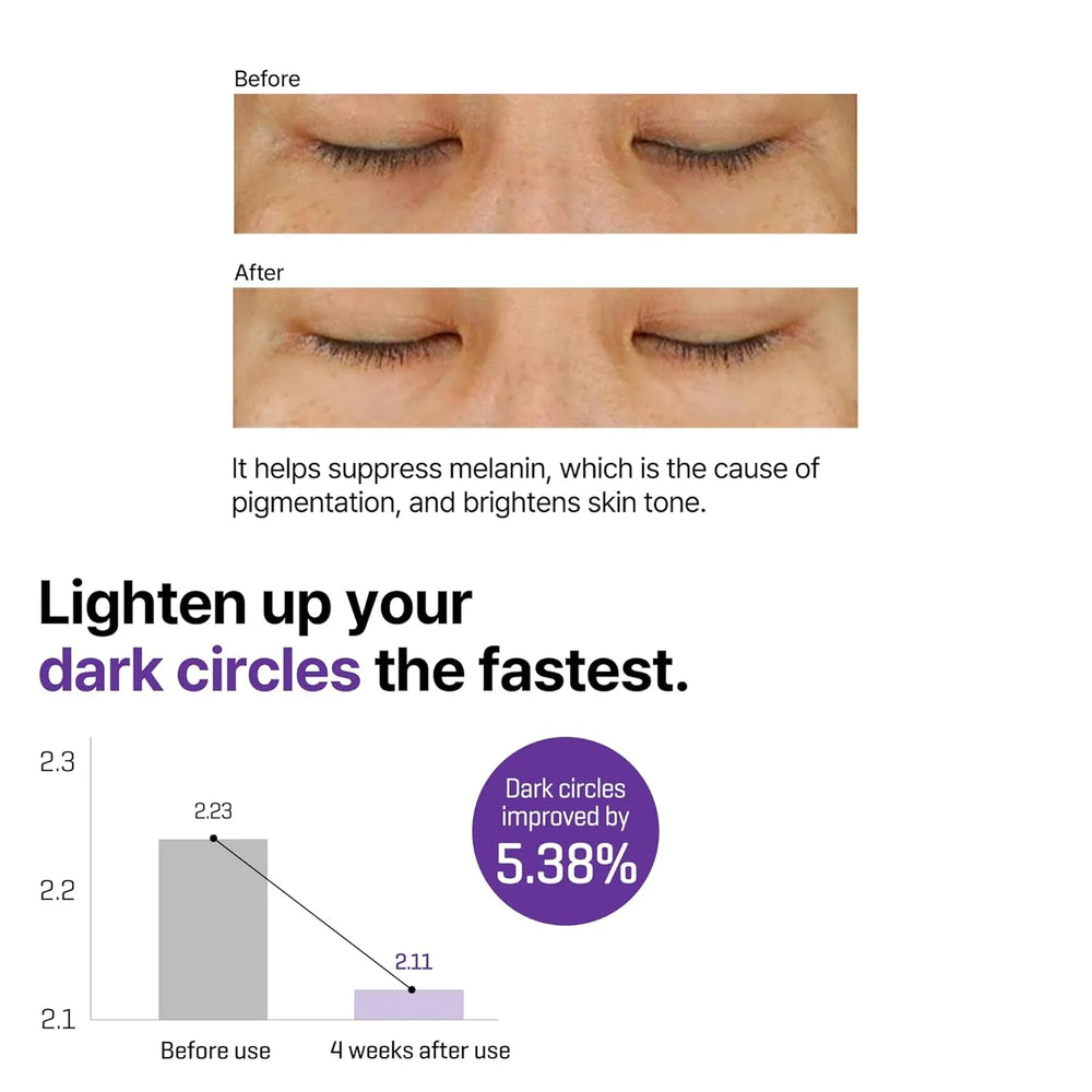 Some By Mi - Retinol Intense Advance Triple Action Eye Cream - 30ml - Made in Korea Some By Mi