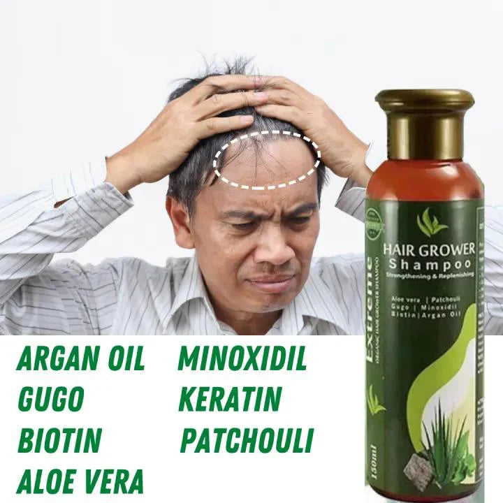 Sunisa Aloe Vera Hair Growth Shampoo - 150ml Sunisa