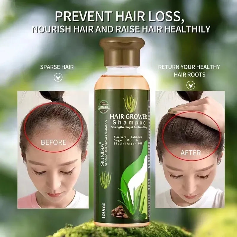 Sunisa Aloe Vera Hair Growth Shampoo - 150ml Sunisa