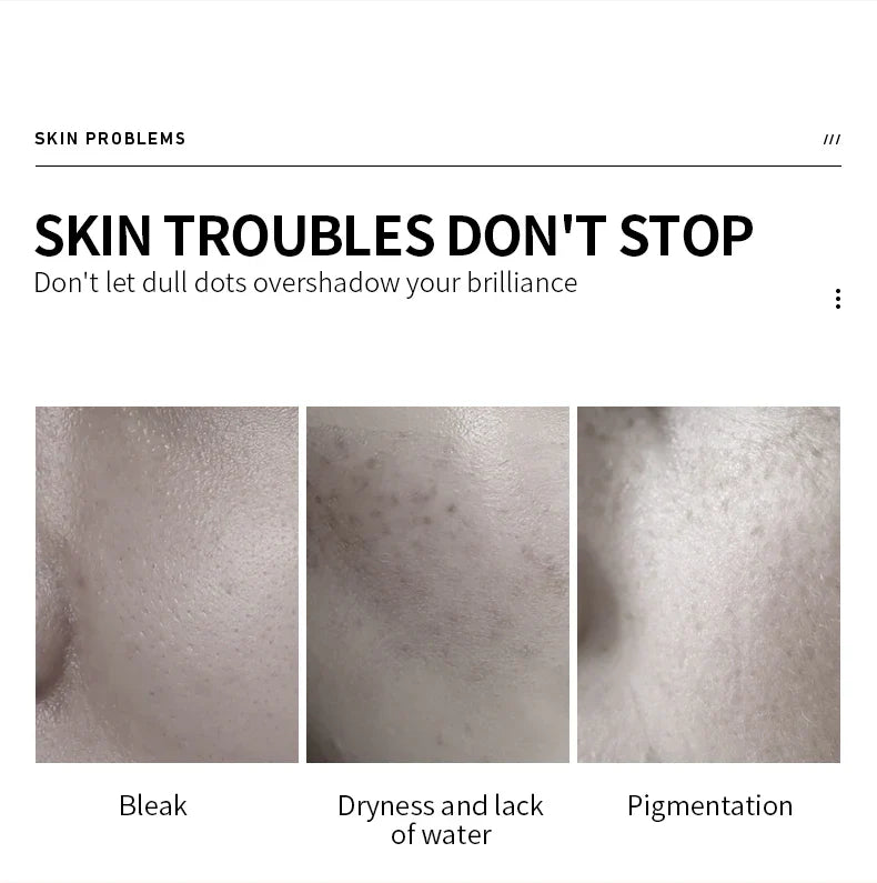 VEZE Moisturizing for the face, pore reduction, freckles, and smooth - 100ml Veze