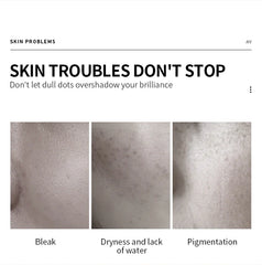 VEZE Moisturizing for the face, pore reduction, freckles, and smooth - 100ml Veze