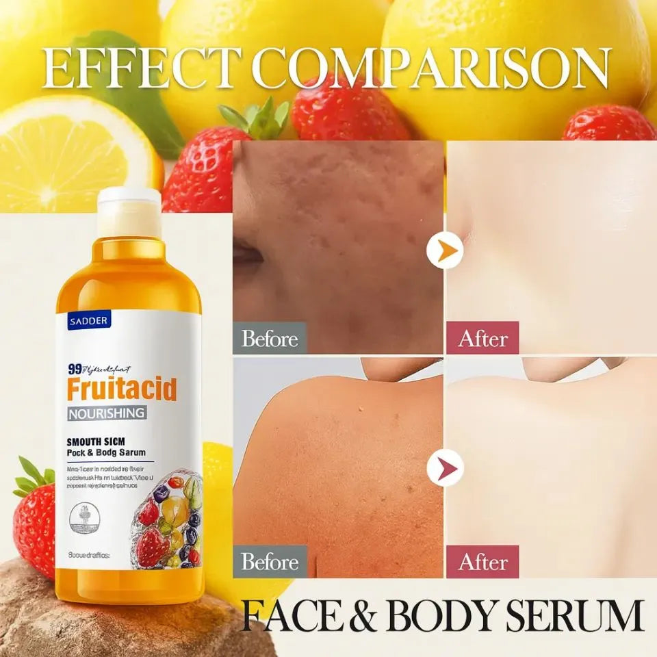 Sadoer Fruit Acid Face & Body Serum - 500ml Sadoer