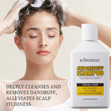KORMESIC Nourishing Moisturizing Smoothing Refreshing Fluffy Anti-Dandruff Oil Control Shampoo – 260ml