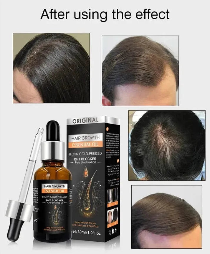 Hair Growth Essential Oil – Biotin Cold-Pressed DHT Blocker – 30ml Cosmia.pk