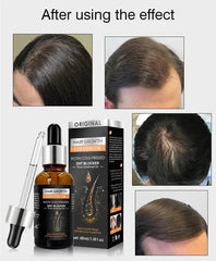 Hair Growth Essential Oil – Biotin Cold-Pressed DHT Blocker – 30ml Cosmia.pk