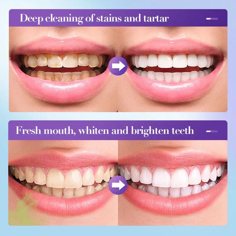 Sadoer V34 Remove Yellow Teeth Stains Whitening Toothpaste – 28 ml Sadoer