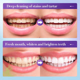Sadoer V34 Remove Yellow Teeth Stains Whitening Toothpaste – 28 ml