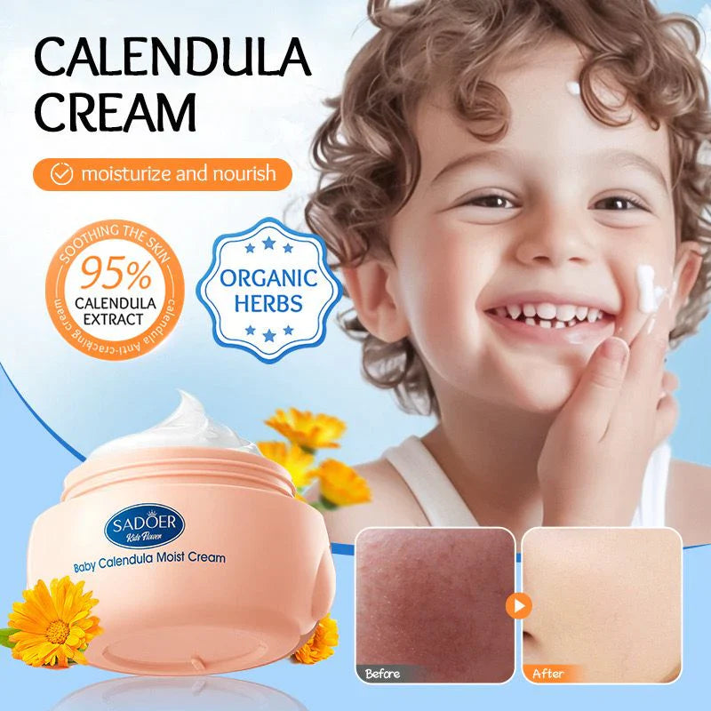 Sadoer Calendula Amino Acid Formula Baby Moist Cream – 50 g Sadoer