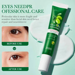 ZOZU Olive Oil Eye Cream Remove Dark Circles Reduce Fine Lines Zozu