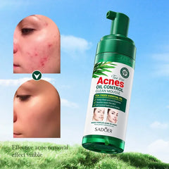 Sadoer Mousse Facial Cleanser Tea Tree 150g Sadoer