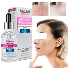 Kojic Acid Whitening Facial Serum - 30ml Kojic