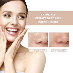 Lakme Rose Face & Body Exfoliating Gel - 100g Lakme