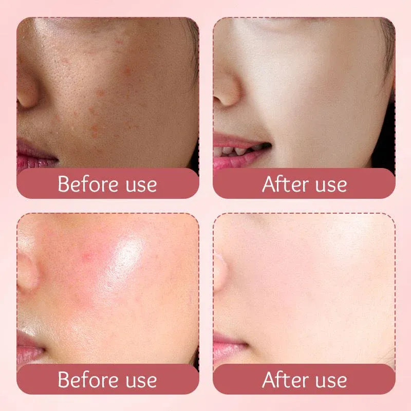 Sadoer Hydro Boost Milk Peach Whitening Moisturizing Face Cream - 80g Sadoer
