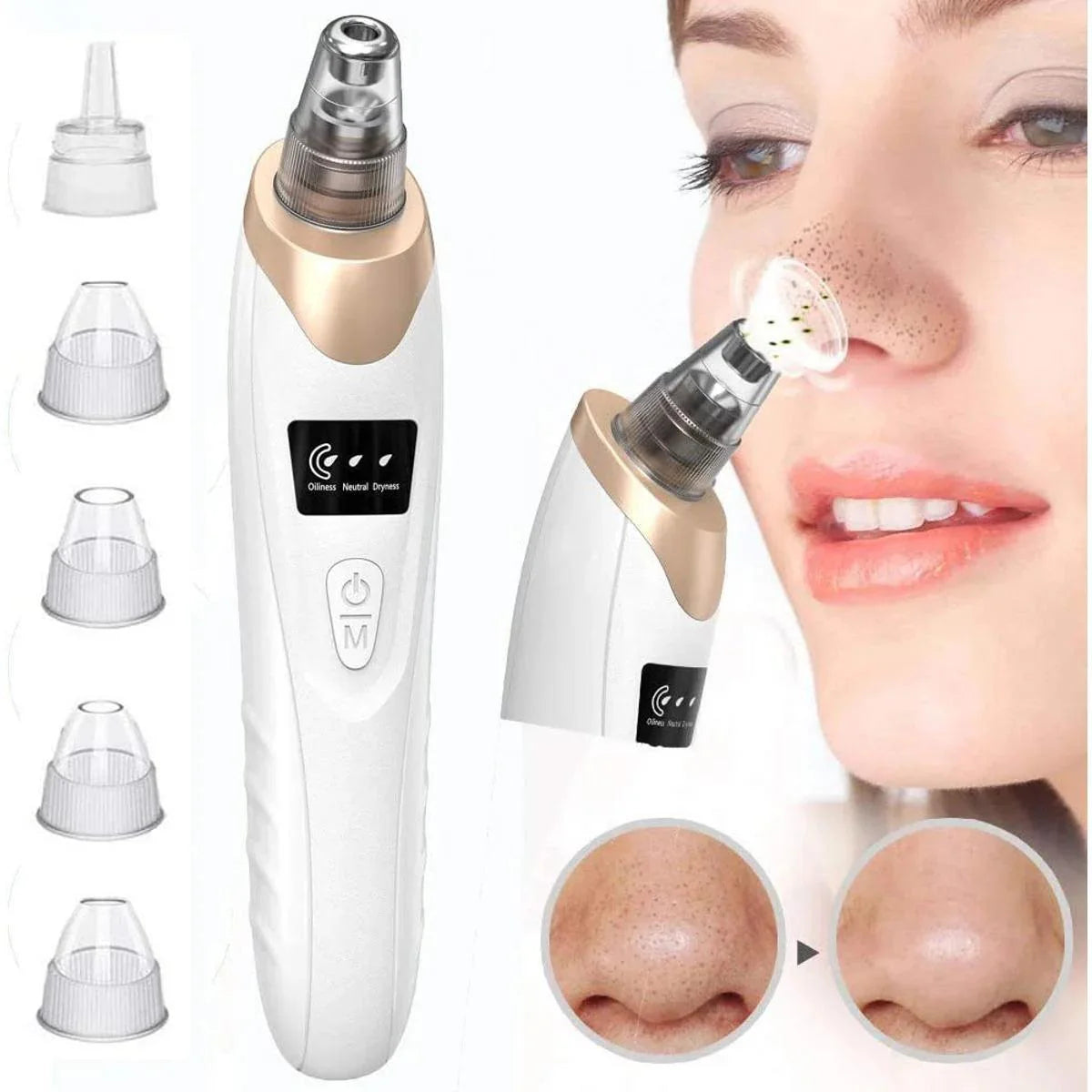Electric Blackheads Remover Beauty Tool Cosmia.pk