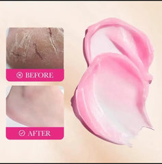 Sadoer Anti Dead Skin Squalene Peach Repair Cream - 70g Sadoer