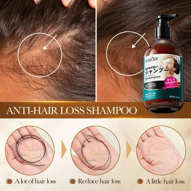 SADOER Anti Hair Loss Shampoo Anti-dandruff Hair Growth Shampoo - 300ml Sadoer