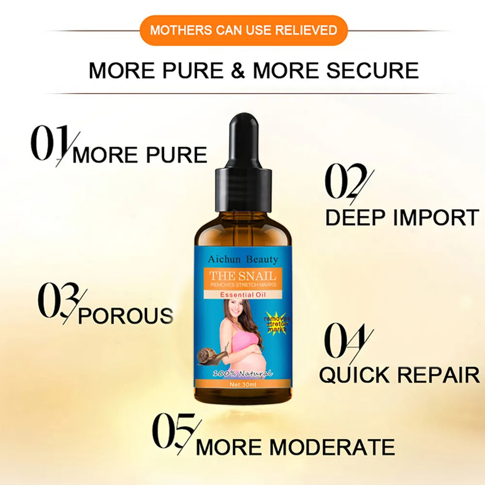 Aichun Beauty The Snail Remove Stretch Marks Essential Oil - 30ml Aichun Beauty