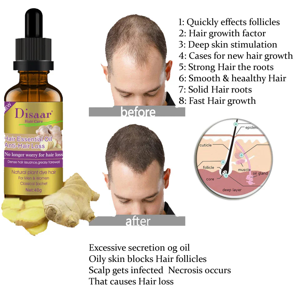 Disaar Anti-Hair Loss Ginger Oil – 30g Disaar