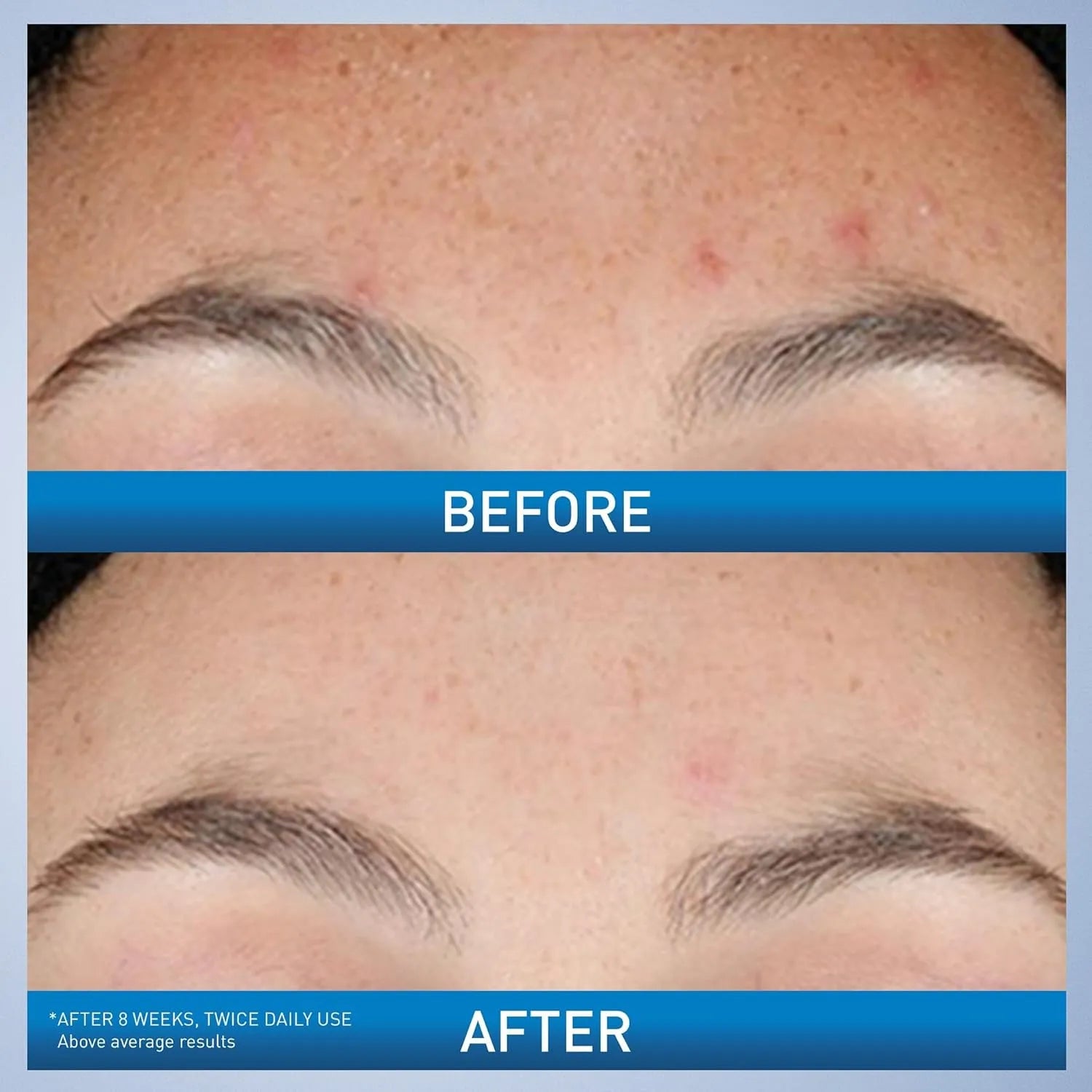 CeraVe Resurfacing Retinol Serum – 30ml CeraVe