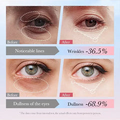SADOER 4in1 Roll-on Moisturizing Eye Cream - 20gm Sadoer