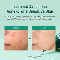Some By Mi 14-Day Spot Treatment - 30ml Some By Mi