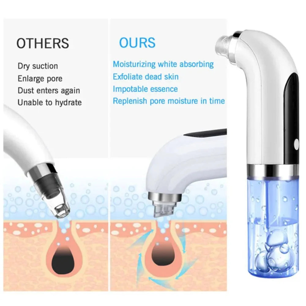 Hydra Facial Black Head Remover Pore Vacuum Micro Bubble Pore Cosmia.pk