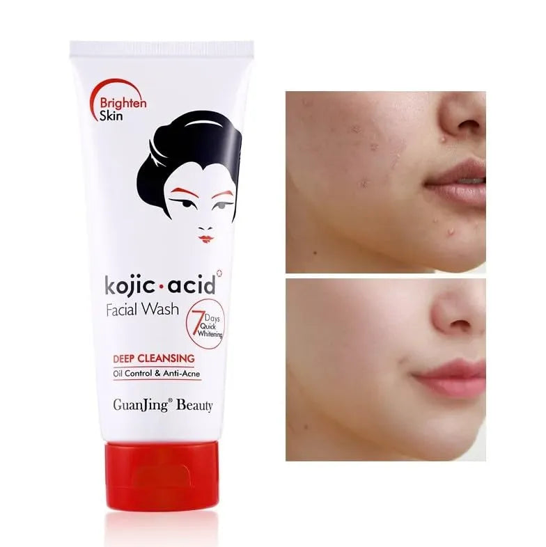 Kojic Acid Facial Wash - 100g Kojic Acid