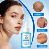 Sadoer 8D Hyaluronic Acid Anti-Wrinkle Serum – 30ml
