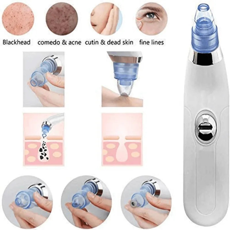 DermaSuction Cell Operated Blackhead Remover with 4 Suction Heads Cosmia.pk