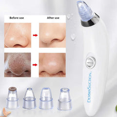 DermaSuction Cell Operated Blackhead Remover with 4 Suction Heads Cosmia.pk