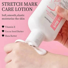 KORMESIC Stretch Mark Care Lotion – 200ml KORMESIC