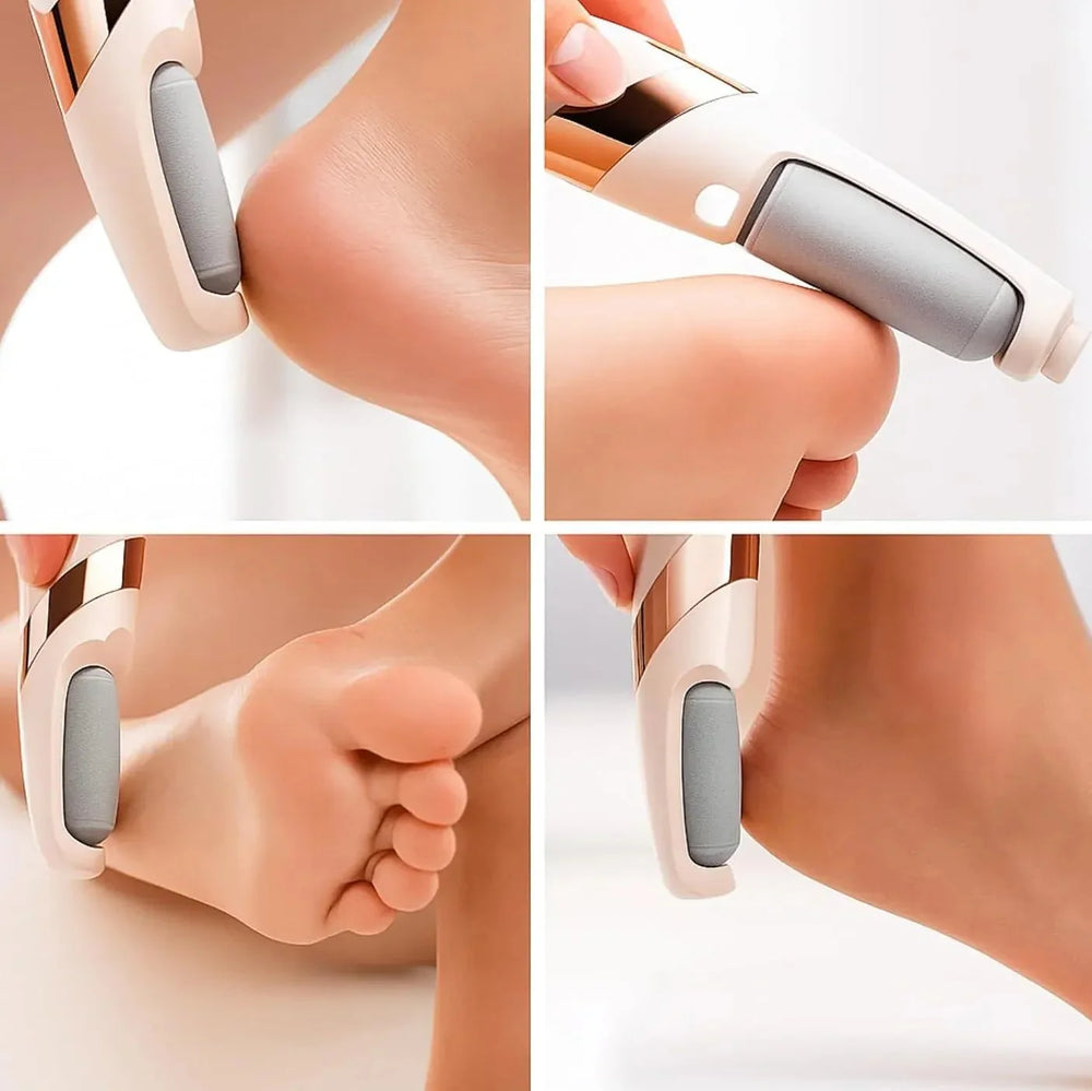Pretty Girl Pedi Electronic Pedicure Tool – Rechargeable Foot File Pretty Girl