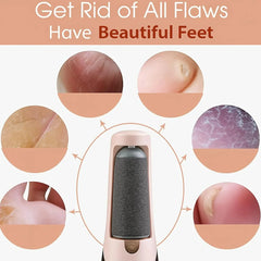 Pretty Girl Pedi Electronic Pedicure Tool – Rechargeable Foot File Pretty Girl