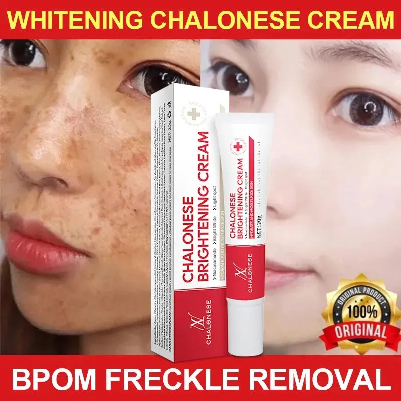 CHALONESE Brightening Cream Serum – 20g CHALONESE