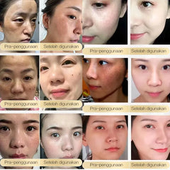 CHALONESE Brightening Cream Serum – 20g CHALONESE