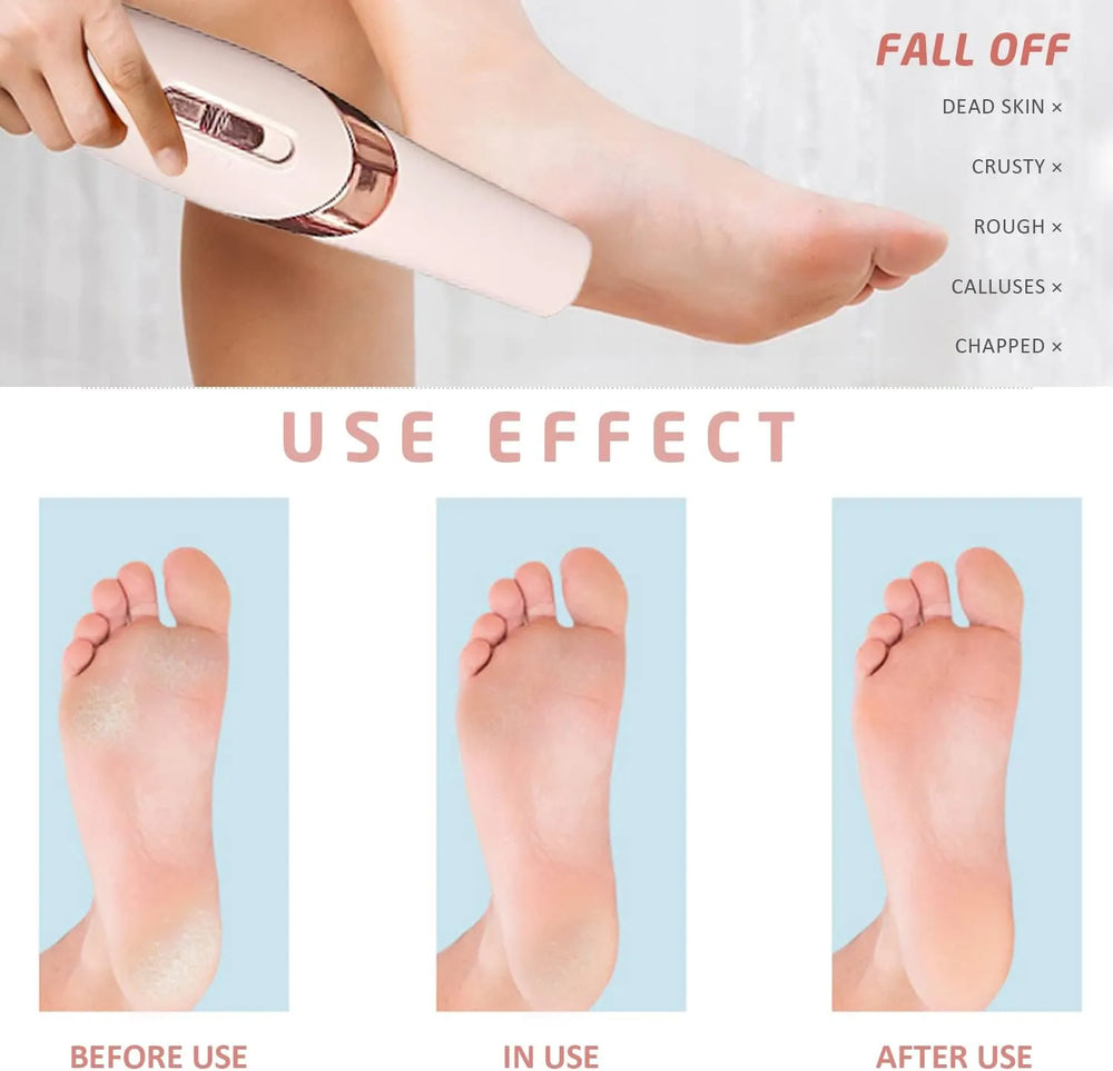 Rechargeable Electric Foot Grinder Cosmia.pk