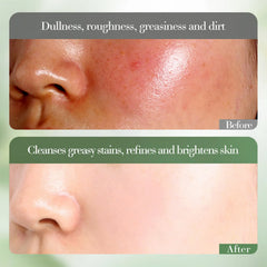 SADOER Vitamin C Whitening Amino Acid Gentle Cleanser- 150g Sadoer
