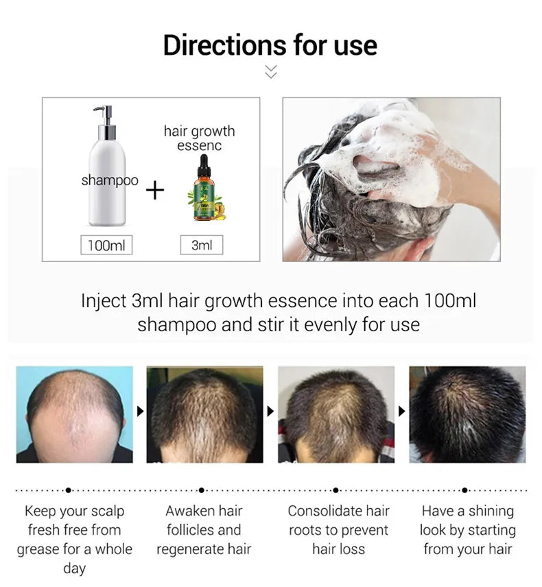 Aichun Beauty 7 Days Ginger Hair Growth Oil Serum For Damaged Hair Aichun Beauty