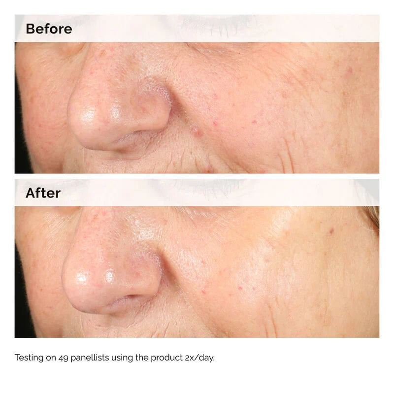The Ordinary Alpha Arbutin 2% + HA Serum - 30ml The Ordinary
