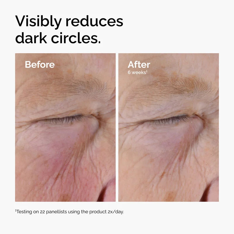 The Ordinary Caffeine Solution 5% + EGCG The Ordinary