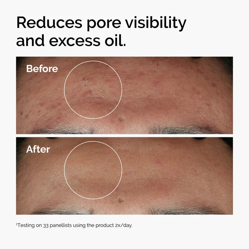The Ordinary Niacinamide 10% + Zinc 1% Serum - 30ml The Ordinary
