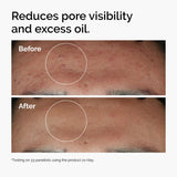The Ordinary Niacinamide 10% + Zinc 1% Serum - 30ml