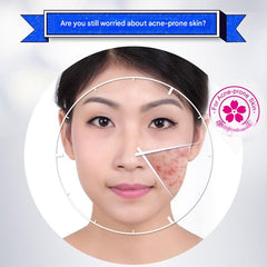 BIOAQUA Moisturizing Rejuvenating Acne Cream - Soothing & Blemish Bioaqua