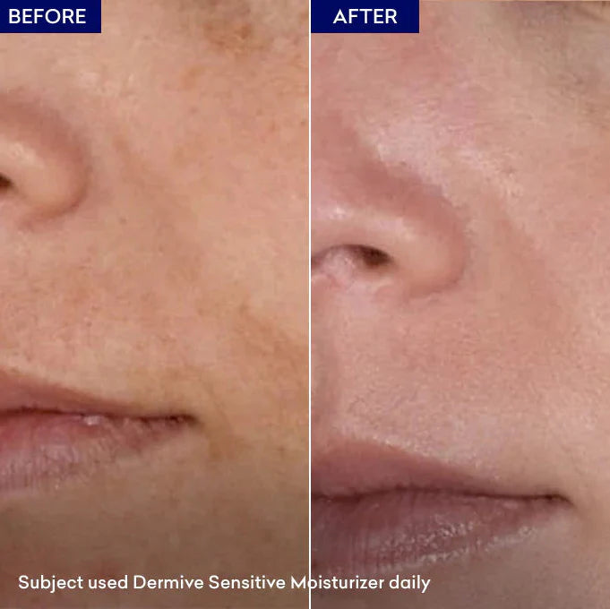 Dermive Sensitive Moisturizer Soothes Skin | Relieves Itching - 100ml Jenpharm