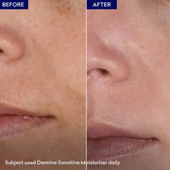 Dermive Sensitive Moisturizer Soothes Skin | Relieves Itching - 100ml Jenpharm