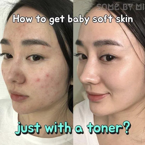 SOMEBYMI - AHA BHA PHA 30 Days Miracle Toner - 150 ml SOMEBYMI